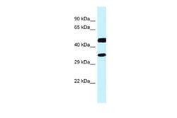 RDH13 Rabbit anti-Human, Polyclonal, Novus Biologicals 0.1 mL | Buy Online | Novus Biologicals | Fisher Scientific